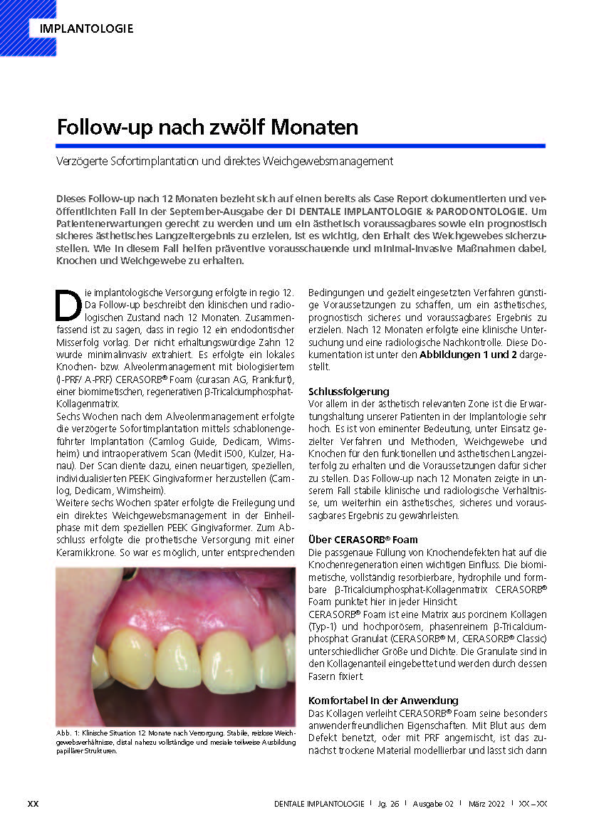 Fallbericht in „Dentale Implantologie“